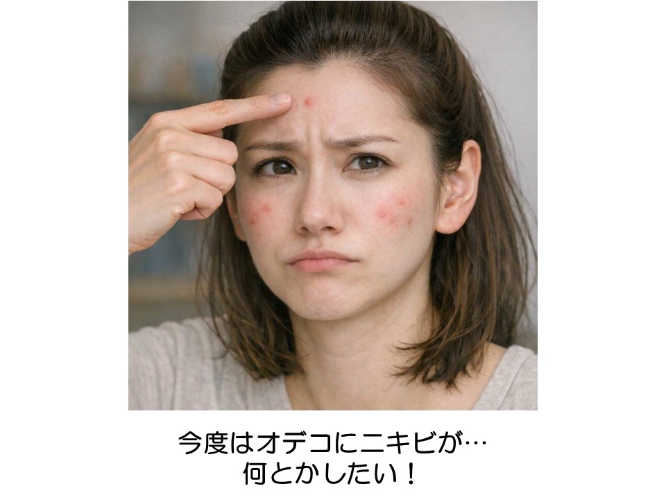 ニキビ,悩み,解消,消したい,石鹸,洗顔,アトピー