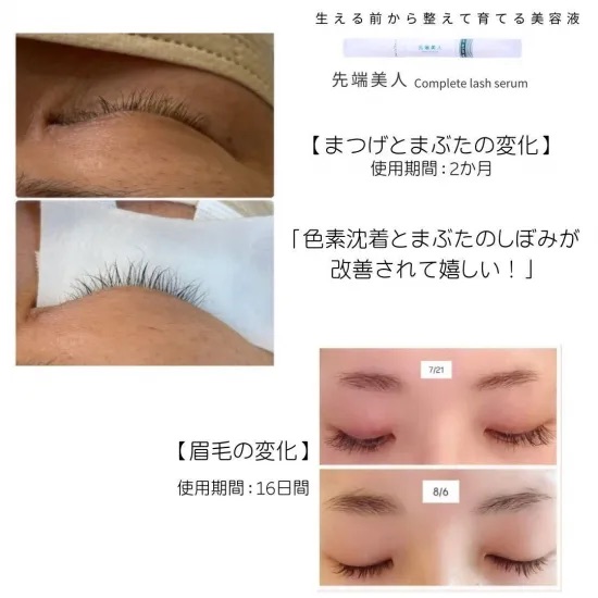 【まつ毛美容液】先端美人コンプリートラッシュセラムの画像