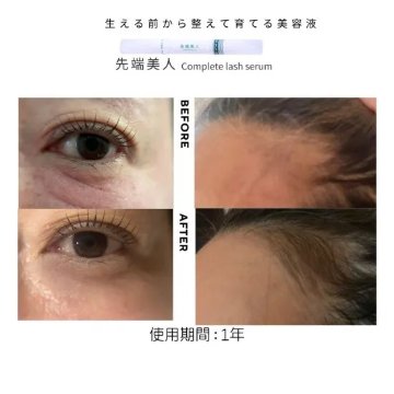 【まつ毛美容液】先端美人コンプリートラッシュセラムの画像