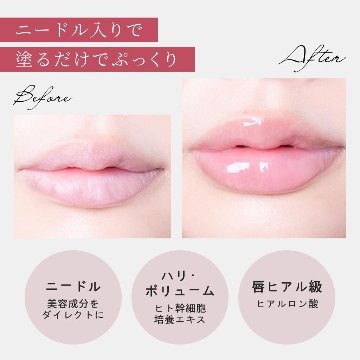 アガリズム リッププランパー リップ 透明 ヒアルロン酸 ヒト幹細胞 プランパー リップグロス リップクリーム リップケア リップ美容液 マイクロニードル | AGARISM Q+Me ボムショット の画像