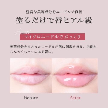 アガリズム リッププランパー リップ 透明 ヒアルロン酸 ヒト幹細胞 プランパー リップグロス リップクリーム リップケア リップ美容液 マイクロニードル | AGARISM Q+Me ボムショット の画像