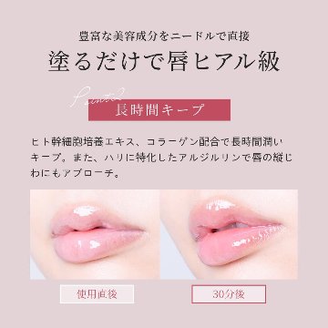 アガリズム リッププランパー リップ 透明 ヒアルロン酸 ヒト幹細胞 プランパー リップグロス リップクリーム リップケア リップ美容液 マイクロニードル | AGARISM Q+Me ボムショット の画像