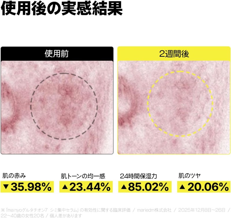 グルタチオンセブン ダークスポットセラム30ml 美容液 無臭 グルタチオン 純度99％ トーンアップ manyo 韓国コスメの画像